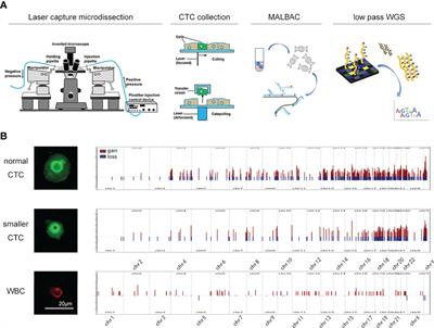 A Novel Karyoplasmic Ratio-Based Automatic Recognition Method for Identifying Glioma Circulating Tumor Cells